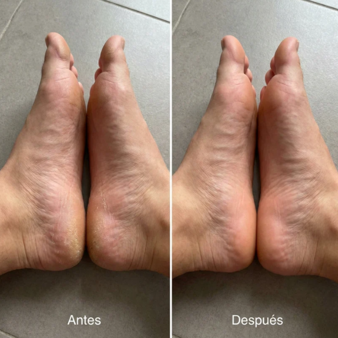 Lima Removedora Exfoliante de Callos